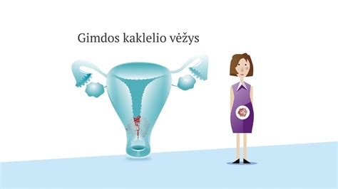 Gimdos kaklelio anatomija