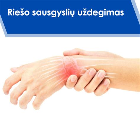 Akupresūriniai taškai ant riešo