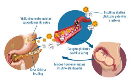 Schema apie virškinimo sistemos sutrikimus nėštumo metu