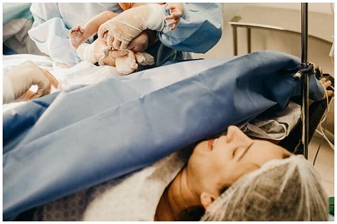 vizualizacija su pjūvio vietomis cezario operacijos metu