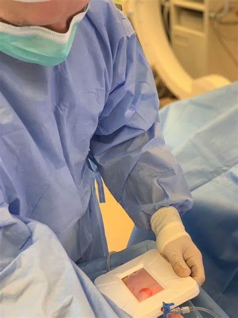 Kiaušialąsčių paėmimo procedūra