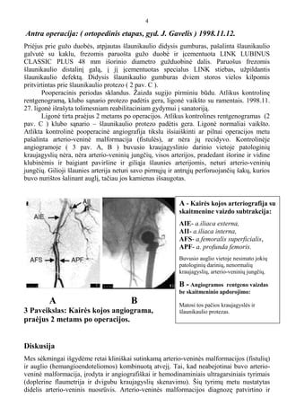 Chirurginio gydymo schema