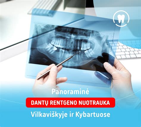 Infografika apie protinių dantų problemas