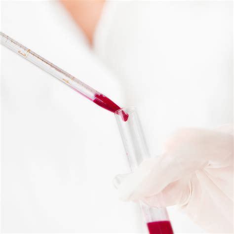 laboratorinė aplinka su kraujo mėgintuvėliais ir tyrimų įranga