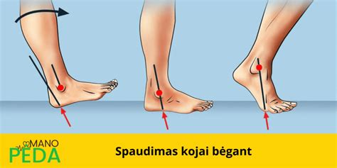 Schematinis vaizdas, kaip formuojasi vaiko pėdos skliautas