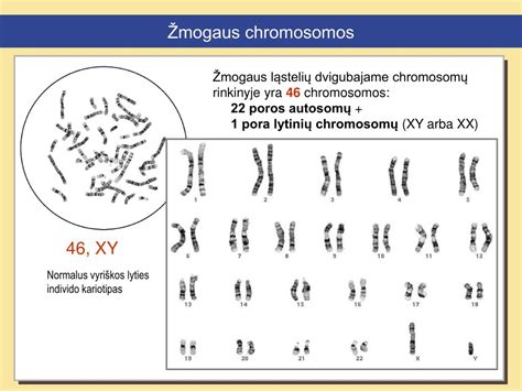 Žmogaus chromosomos ir lyties nustatymas