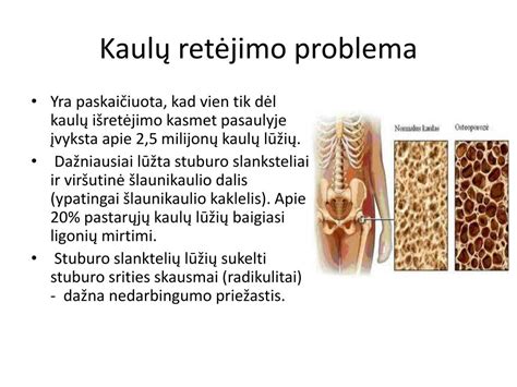Kaulų tankio mažėjimo schema