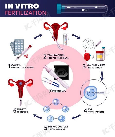 IVF ir ICSI procedūrų schemos