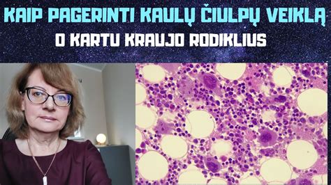 Kaulų čiulpų transplantacijos procedūra