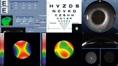 Vaiko akių patikrinimas