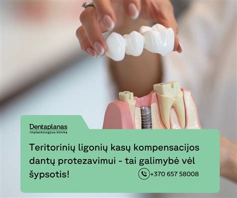 Schema: Kaip gauti dantų protezavimo kompensaciją