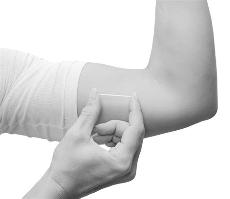 Kontraceptinio implanto schema