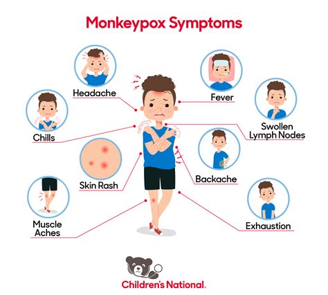 children with mild symptoms of monkeypox