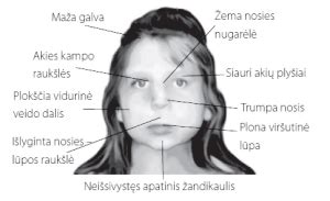 nuotrauka su VAS būdingais veido bruožais