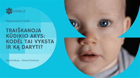 kūdikio akys su paraudimu