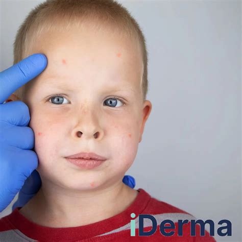 vaikų dermatologas konsultuoja