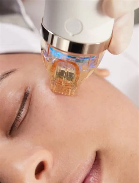 lazerinė dermatologija vaikams