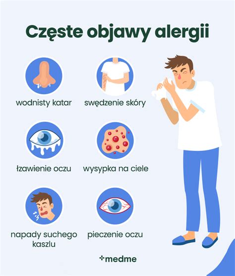 Alergijos simptomai vaikams