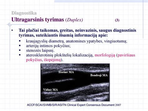 ultragarsinis peties sąnario tyrimas