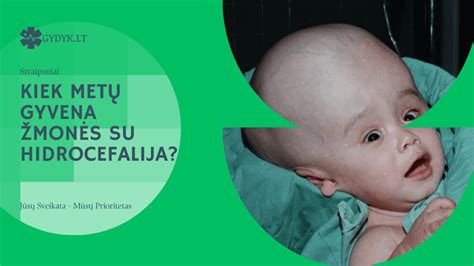 schematinis smegenų pjūvis su hidrocefalija