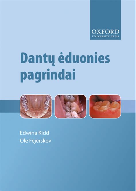 scheminis dantų ėduonies vystymosi pavaizdavimas