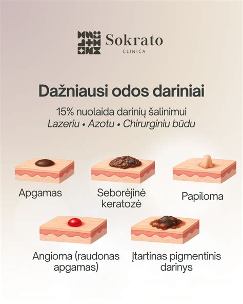 Odos prie odos kontaktas po gimdymo