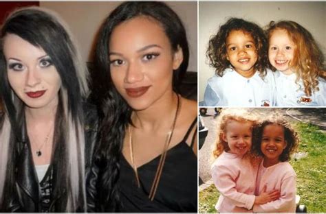 dvyniai skirtingų rasių