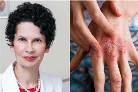 vaikų odos ligų palyginimas