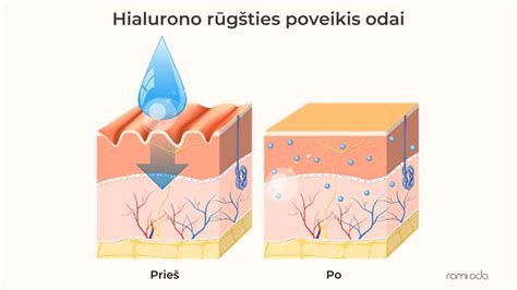 Schema: Kaip hialurono rūgštis veikia organizme