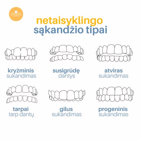 vaikų sąkandžio problemos