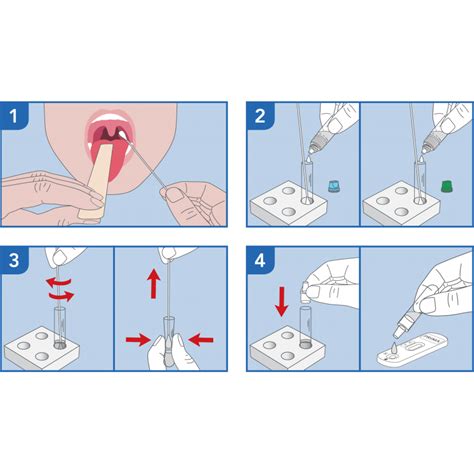 Infografika: Streptokoko antigeno testas - greitas būdas nustatyti infekcijos kilmę