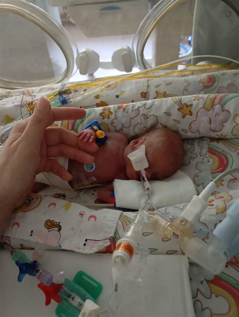 Statistika: naujagimių, gimusių mažiau nei 300g, išgyvenamumas