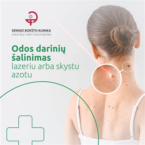 Įvairių odos darinių palyginimas