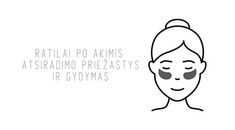 Strijų atsiradimo priežastys ir prevencija