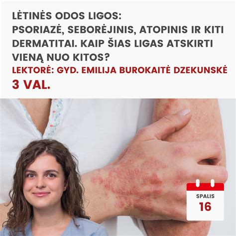 Schema, kaip atskirti kampinį cheilitą nuo herpes viruso