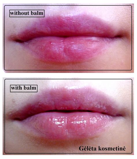 Vaikas tepasi lūpų balzamą
