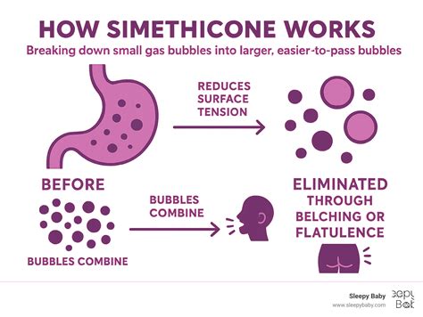 Infographic about simethicone action