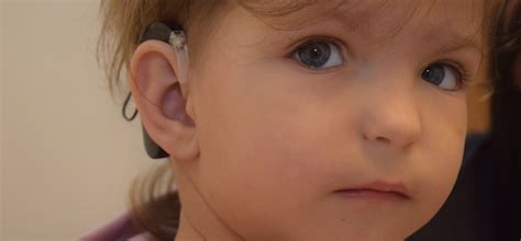 Vaiko su kochleariniu implantu priežiūra