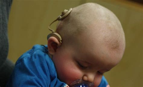 Vaiko su kochleariniais implantais žaidžiantis