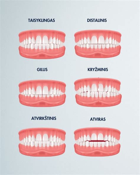 Įvairūs inkubatorių tipai