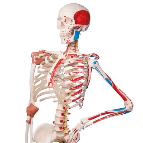 Schema, kaip atrodo naujagimio skeletas su pažymėtais dažniausiai traumų pažeidžiamais kaulais
