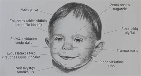 Kūdikio veidas su plačiu tarpuakiu