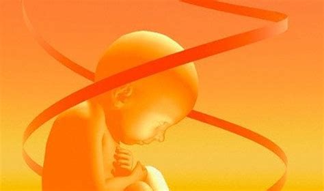 Embriono vystymosi sutrikimai