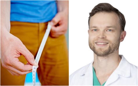 Varpos pasaitėlio plastikos operacija
