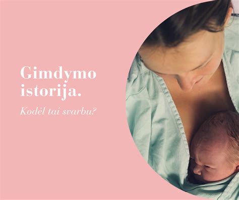 Gimdymo sužadinimo metodai